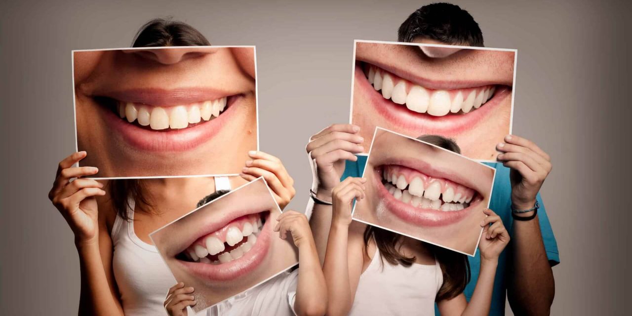 https://mdentalpractice.com/wp-content/uploads/2020/12/m-dental-practice-kako-izbeleti-potamneo-zub-1280x640.jpg